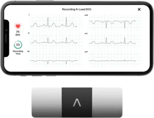 KardiaMobile 6-Lead Personal EKG Monitor
